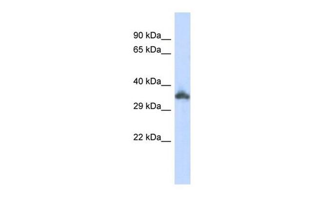 KRTAP24-1 Antibody in Western Blot (WB)