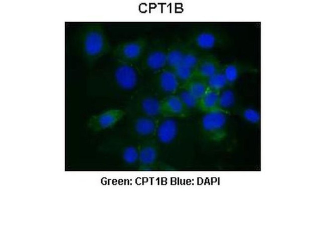 CPT1B Antibody in Immunocytochemistry (ICC/IF)