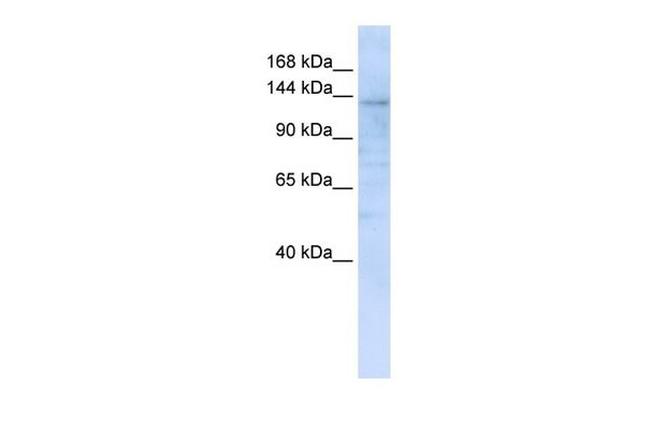 IMPG2 Antibody in Western Blot (WB)