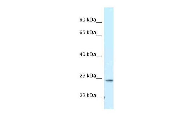 TMEM106B Antibody in Western Blot (WB)