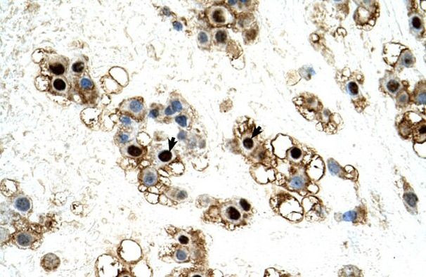 UNCX Antibody in Immunohistochemistry (IHC)