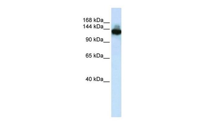 SCAND3 Antibody in Western Blot (WB)