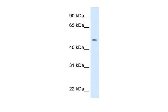 lab Antibody in Western Blot (WB)