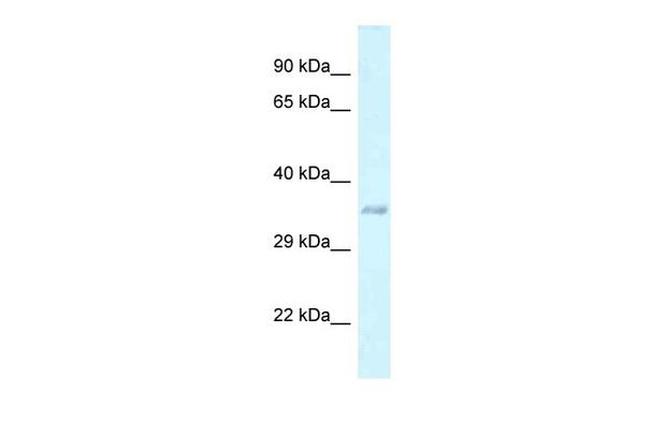 E130311K13Rik Antibody in Western Blot (WB)