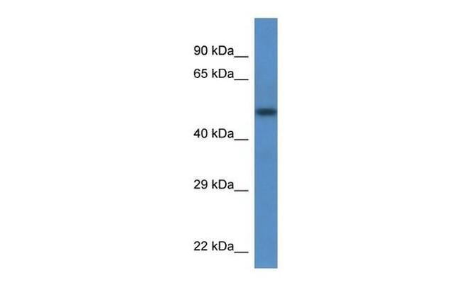 TCN2 Antibody in Western Blot (WB)