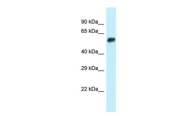 EEPD1 Antibody in Western Blot (WB)