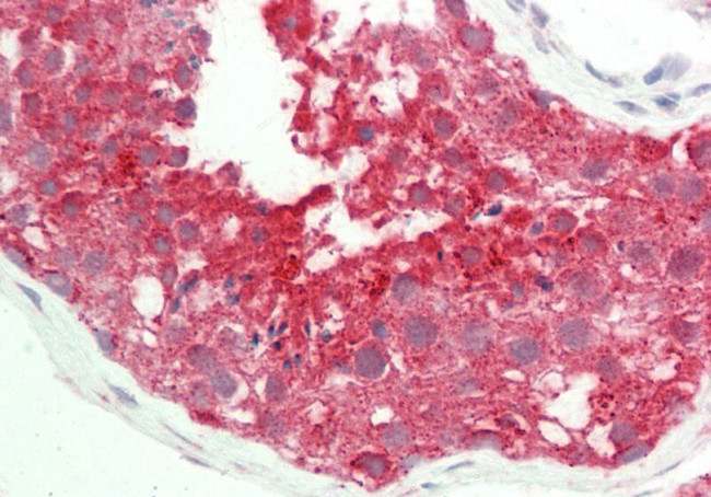 GYG1 Antibody in Immunohistochemistry (Paraffin) (IHC (P))