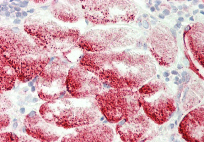 GYG1 Antibody in Immunohistochemistry (Paraffin) (IHC (P))