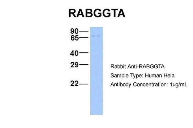 RABGGTA Antibody in Western Blot (WB)