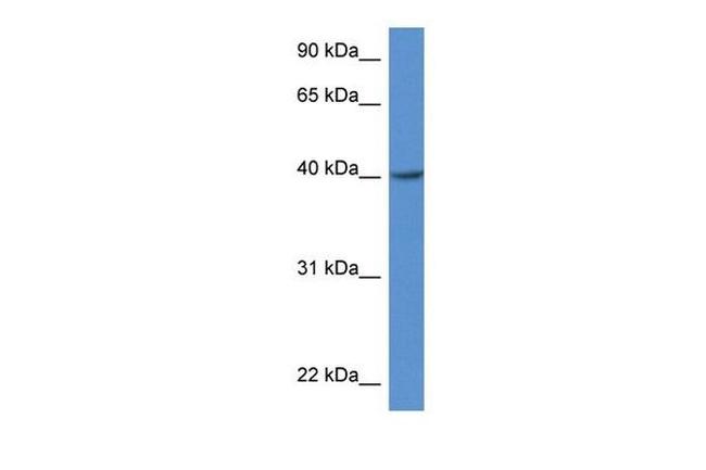 ZDHHC11 Antibody in Western Blot (WB)