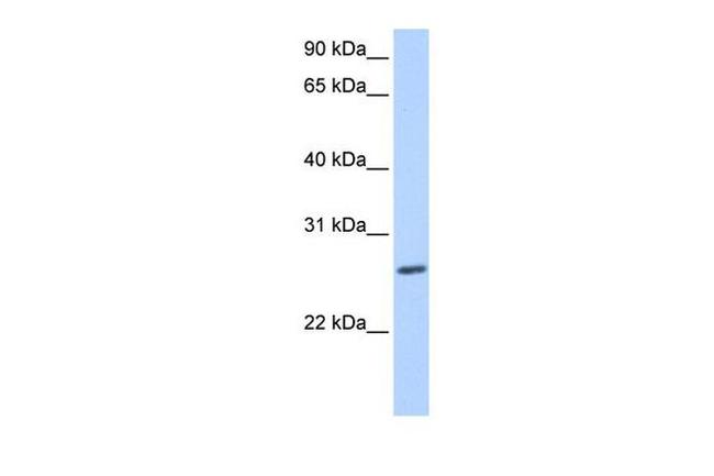 ZNF664 Antibody in Western Blot (WB)