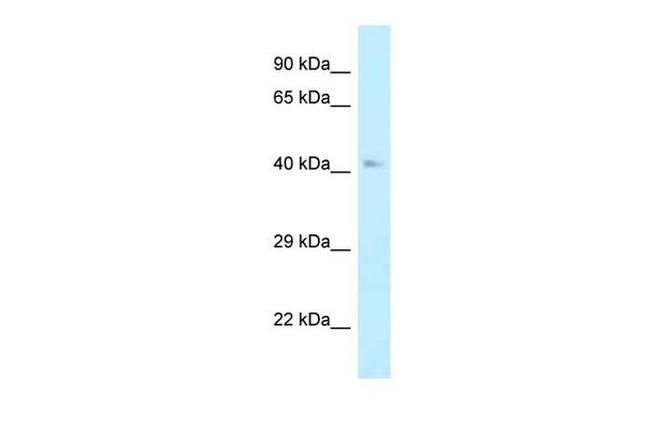 AHCY Antibody in Western Blot (WB)