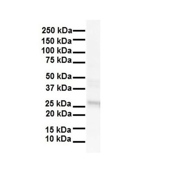 LKAAEAR1 Antibody in Western Blot (WB)