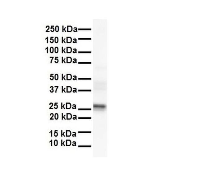 LKAAEAR1 Antibody in Western Blot (WB)