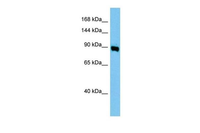 gamma Adaptin Antibody in Western Blot (WB)