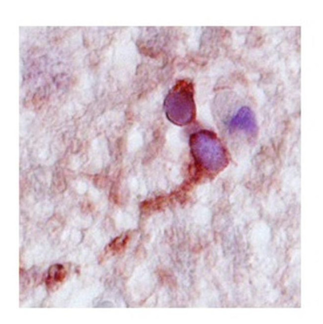 CPLX2 Antibody in Immunohistochemistry (IHC)