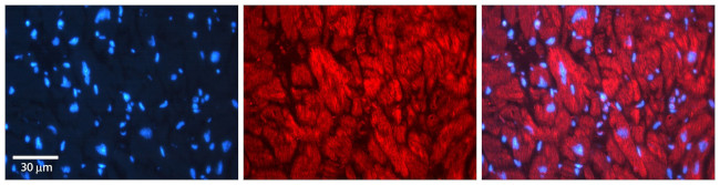 EHD1 Antibody in Immunocytochemistry (ICC/IF)