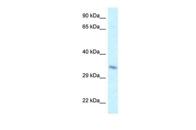 TAF8 Antibody in Western Blot (WB)