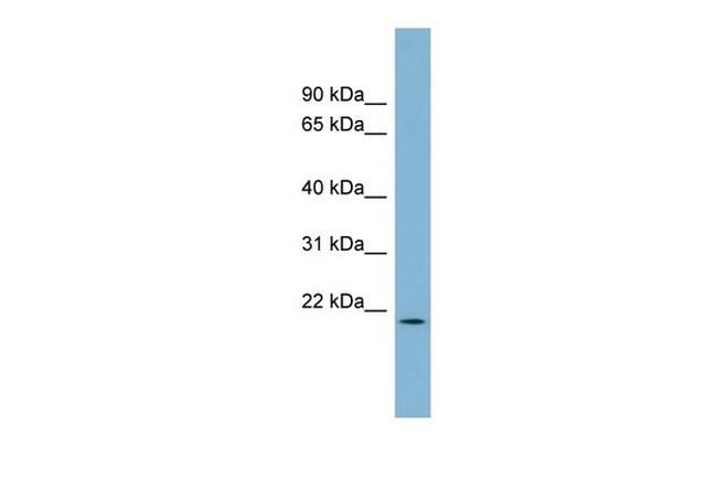 PACRGL Antibody in Western Blot (WB)