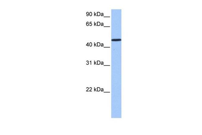 SAMD14 Antibody in Western Blot (WB)