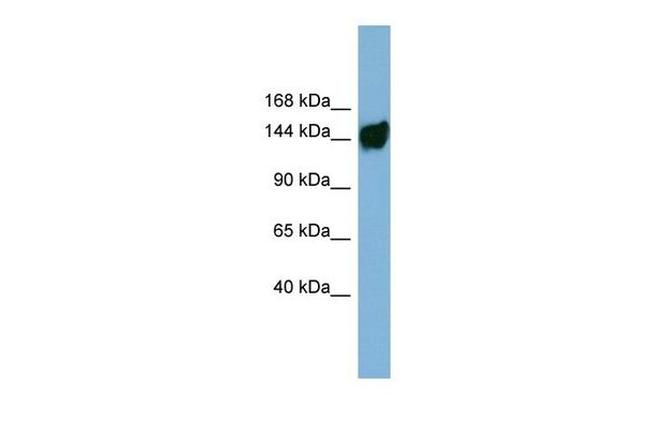 AASDH Antibody in Western Blot (WB)