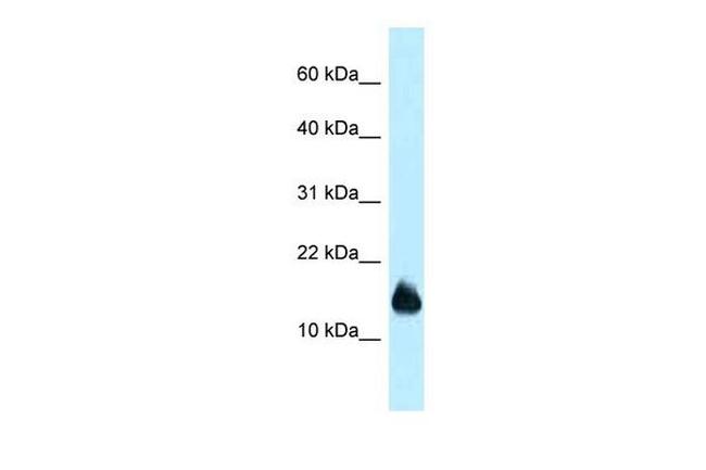 1110059E24Rik Antibody in Western Blot (WB)