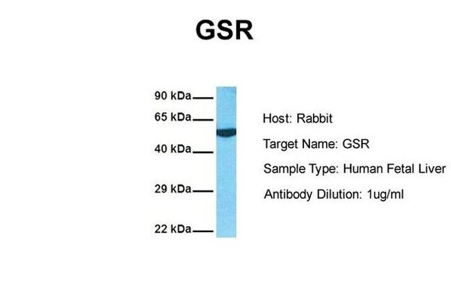 GSR Antibody in Western Blot (WB)