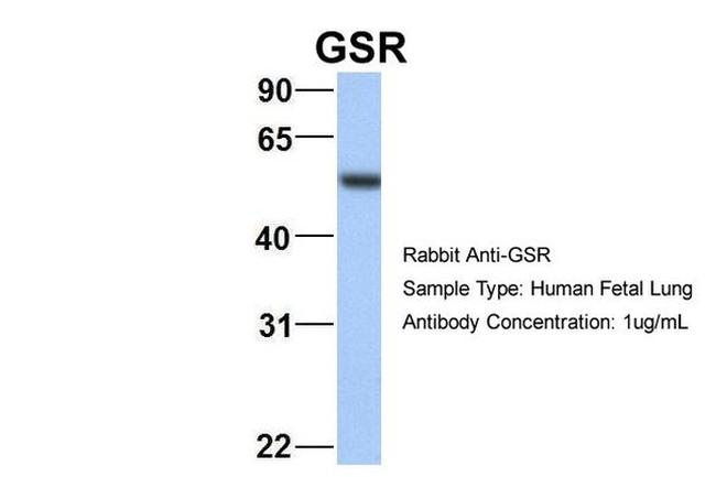 GSR Antibody in Western Blot (WB)