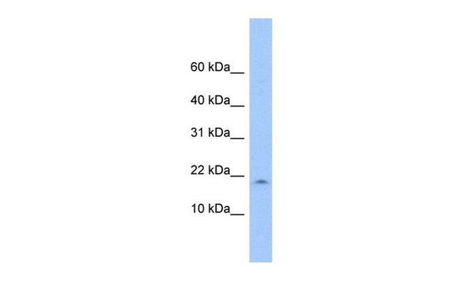 LOC285033 Antibody in Western Blot (WB)