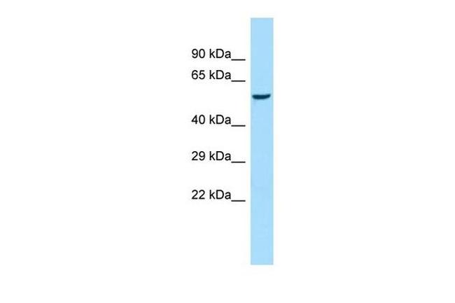 alpha Amylase 1 Antibody in Western Blot (WB)