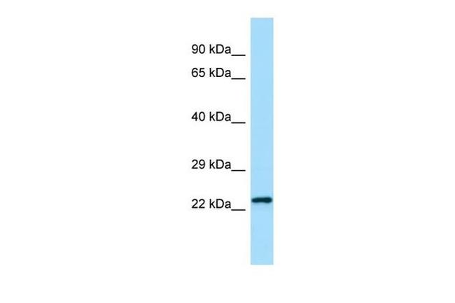 CHMP2B Antibody in Western Blot (WB)