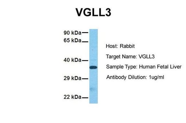 VGLL3 Antibody in Western Blot (WB)