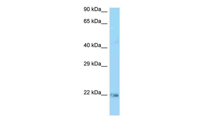 K-Ras Antibody in Western Blot (WB)