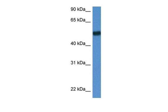 BIN1 Antibody in Western Blot (WB)