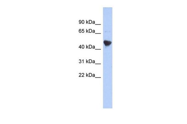 IER5L Antibody in Western Blot (WB)