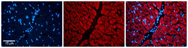 LIS1 Antibody in Immunocytochemistry (ICC/IF)