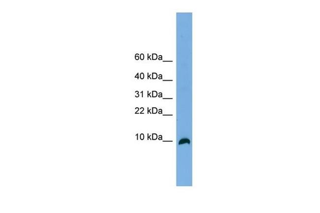 C18orf56 Antibody in Western Blot (WB)