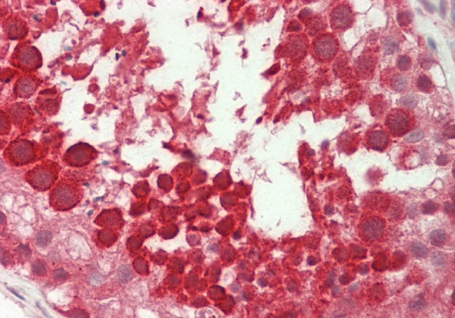 Ubl5 Antibody in Immunohistochemistry (Paraffin) (IHC (P))