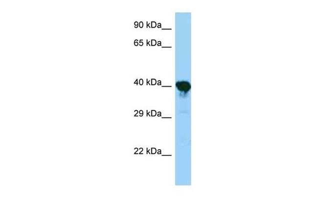 PRPSAP1 Antibody in Western Blot (WB)