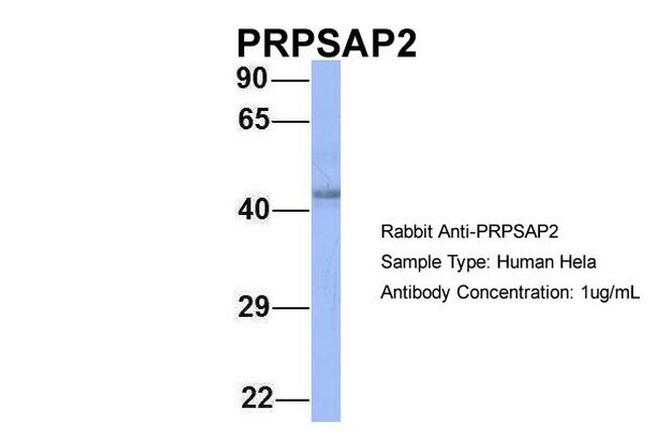 PRPSAP2 Antibody in Western Blot (WB)