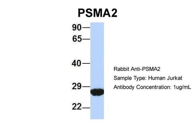 PSMA2 Antibody in Western Blot (WB)