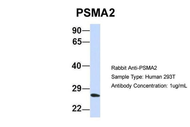 PSMA2 Antibody in Western Blot (WB)