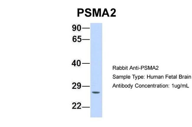 PSMA2 Antibody in Western Blot (WB)