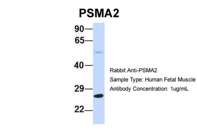 PSMA2 Antibody in Western Blot (WB)