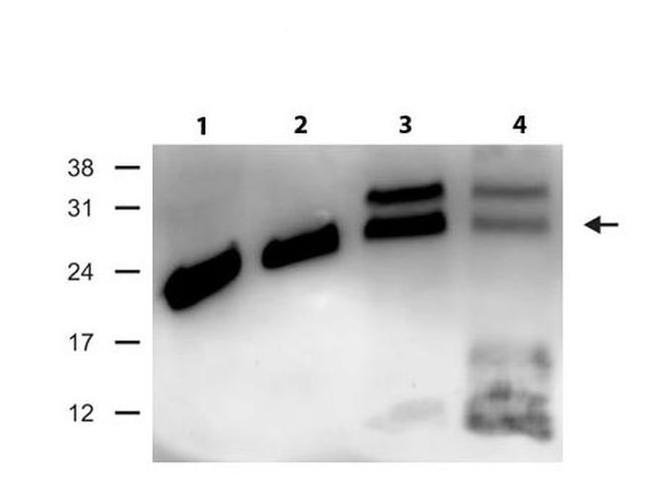 RAB27B Antibody in Western Blot (WB)