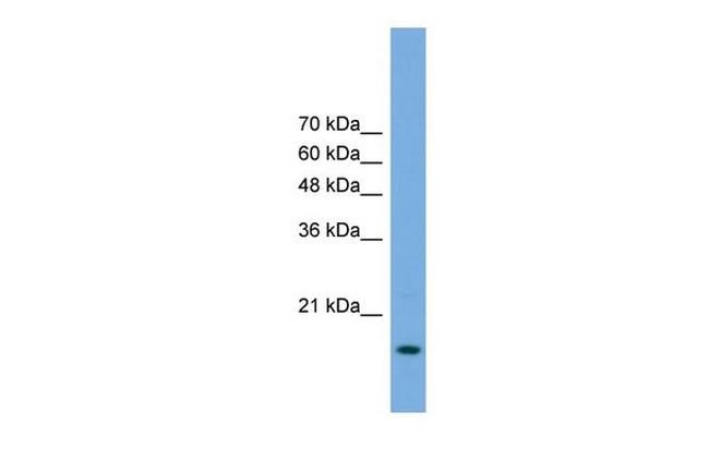 POP5 Antibody in Western Blot (WB)