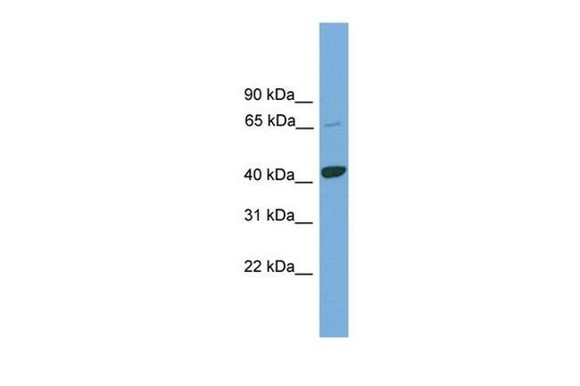 KCTD9 Antibody in Western Blot (WB)