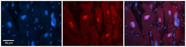 ARIH2 Antibody in Immunohistochemistry (Paraffin) (IHC (P))