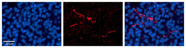 Carboxypeptidase E Antibody in Immunohistochemistry (IHC)