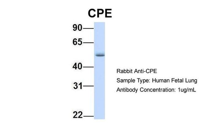 Carboxypeptidase E Antibody in Western Blot (WB)